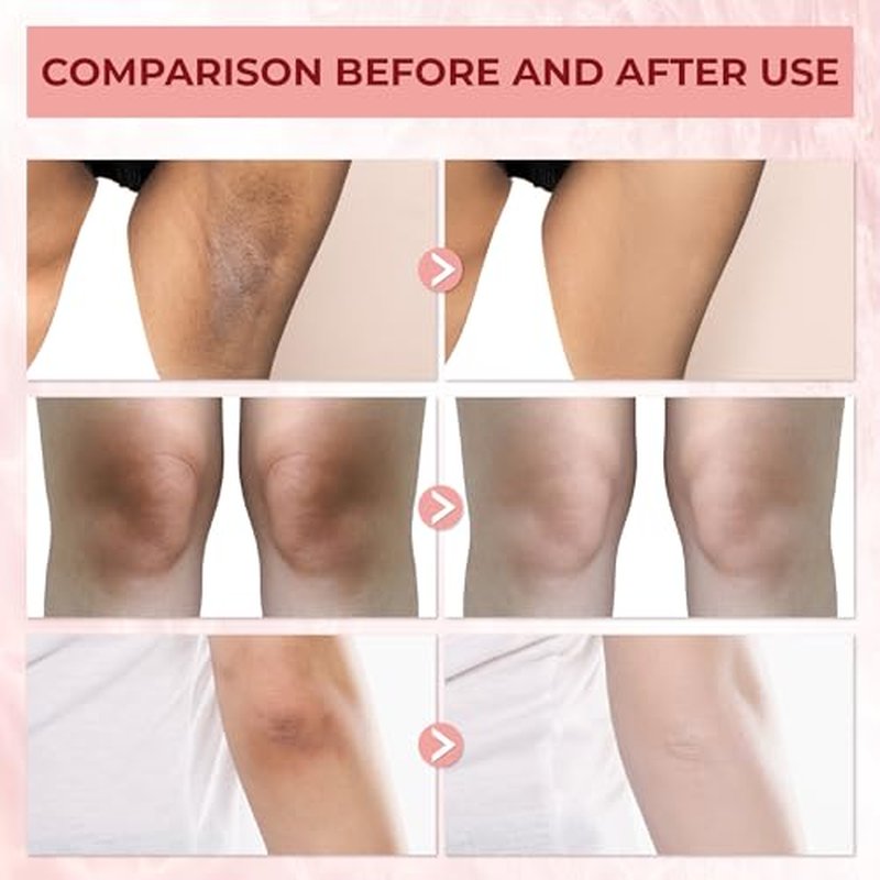 Abera Underarm Dark Spot Corrector Cream with Bearberry Extract, Targeted Armpit Spot Reducer & Sensitive Area Skin Tone Enhancer, Natural Even Tone Solution with Arbutin & Niacinamide