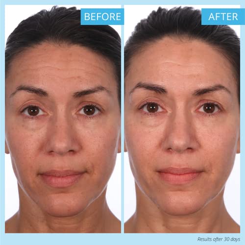 SKINN Reverse Intensive Anti-Aging Face Cream with Hyaluronic Acid & Retinol