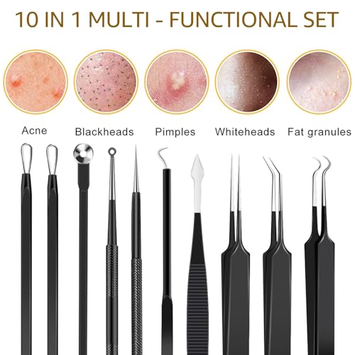 Black 40pcs Professional Pimple Popper Tool Kit for Salons & Estheticians