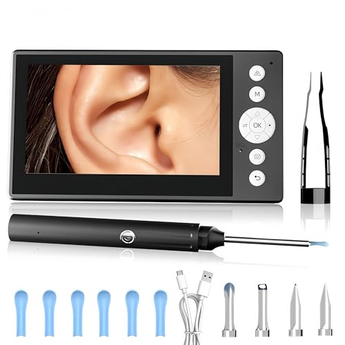 Wireless Ear Otoscope with 4.3-Inch HD Screen and Ear Wax Removal Kit