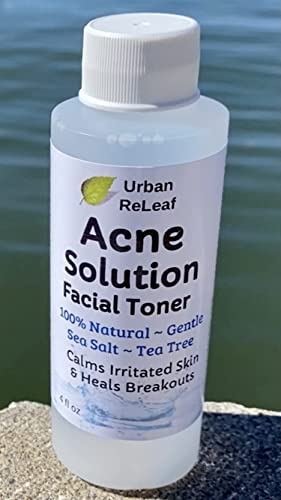 Acne Treatment Toner with Sea Salt & Tea Tree - Calms Skin, Reduces Pores, 4 oz