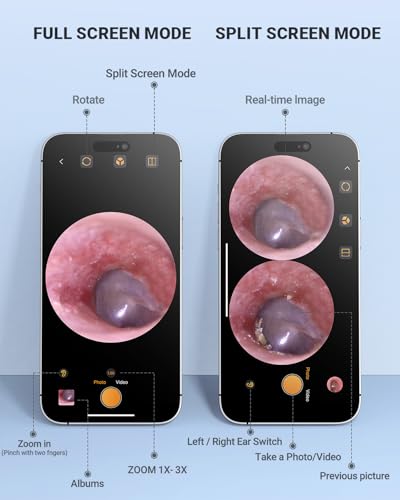 Silver Digital Otoscope Ear Camera with HD Video & LED Lights for iPhone & Android