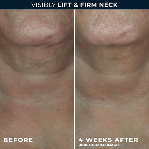 Retinol Hyaluronic Acid Neck Firming Cream - Anti-Aging Moisturizer 1.7 oz