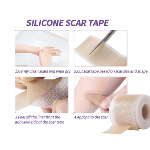 Medical Grade Silicone Scar Sheets - Reusable 1.6" x 60" Scar Removal Tape with Natural Variant