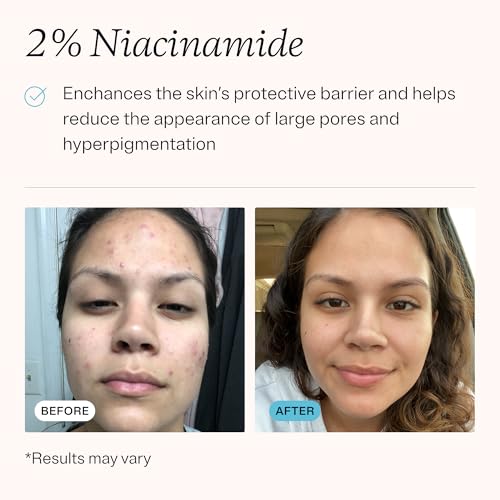 Retinol 0.25% & Niacinamide 2% Face Cream for Acne & Wrinkles - 0.5 fl oz