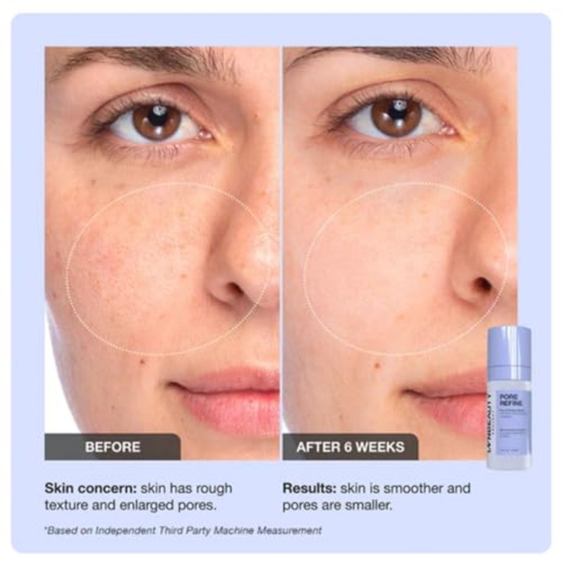 INNBEAUTY PROJECT Pore Refine Pore Shrinking & Texture Smoothing Serum, REFILL, 1 FL OZ (30ml)