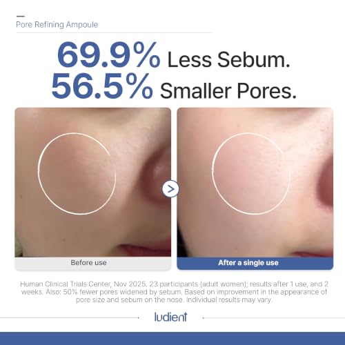 Korean Retinol Serum for Face - Pore Minimizer & Sebum Control, 1.01 Fl Oz