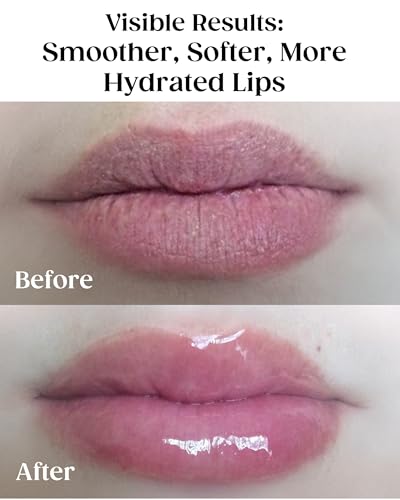 KAPLAN MD Pink Peony Lip Mask & Balm Duo - Hydrating, Plumping, SPF 30