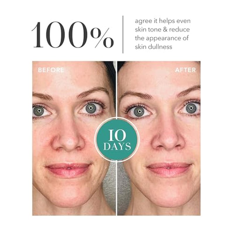 Algenist GENIUS Liquid Collagen Essence - Liquid Collagen Serum with Patented Alguronic Acid to Help Improve Skin Bounce, Elasticity & Radiance (3.4 oz)