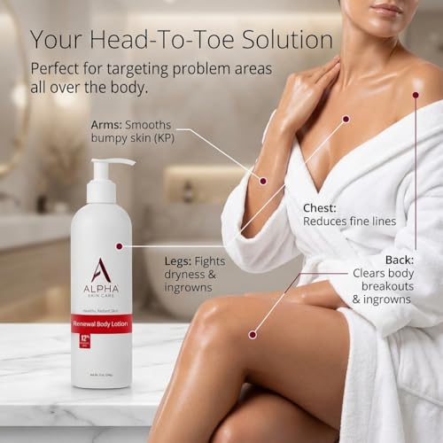 Alpha Skin Care Revitalizing Body Lotion with 12% Glycolic AHA, 12 Oz - Exfoliating & Hydrating