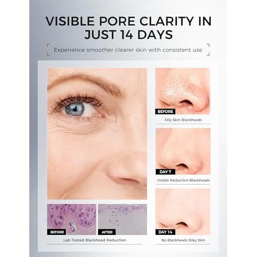 Elastalift Rosehip Oil for face with Vitamin C and Cucumber. Pure Rosehip face oil helps with Wrinkles, Scarring, and Redness for a brighter skin complexion. 1.8 Fl Oz