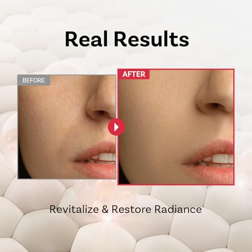 Peptide 11 Botulinum Skin Recovery Ampoule – Elasticity, Radiance & Barrier Support
