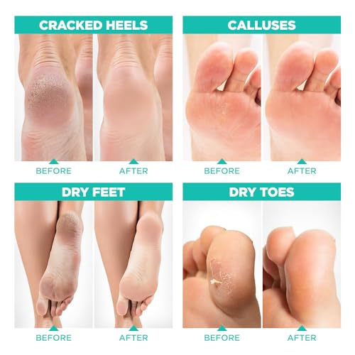 Aloe Vera Foot Peeling Mask for Dry Cracked Feet - Pack of 4, 1 Count Variation