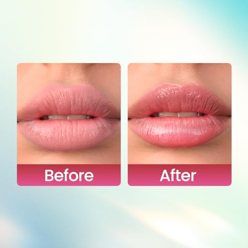 SWISS BEAUTY Kiss Kandy Lip Balm (05), Pink, Adults
