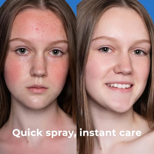 PatchRx Hypochlorous Acid Facial Spray 8oz Pack of 2 Gentle Hydrating Toner & Post-Workout Mist for Sensitive Skin