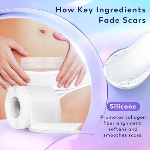 Silicone Scar Sheets, Silicone Scar Tape(1.6"x 120" Roll-3M), Medical Grade Scar Sheets, Scar Tape for Surgical Scars, Burn, C-Section, Keloid Scars, Acne Treatment, Stretch Marks Removal