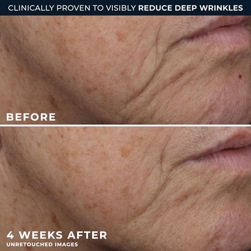 RoC Deep Wrinkle Rich Cream 1.7 Fl Oz Anti-Aging Firming Moisturizer - Fragrance-Free