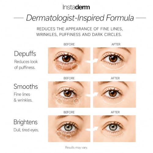 Eye Repair Cream for Dark Circles Puffiness Fine Lines Anti-Aging Niacinamide