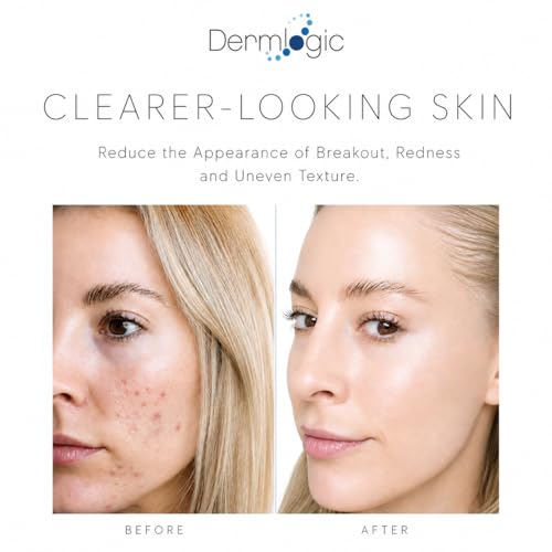 Dermlogic Acne Spot Treatment - Fast-Acting Clear Skin Formula for Face & Body