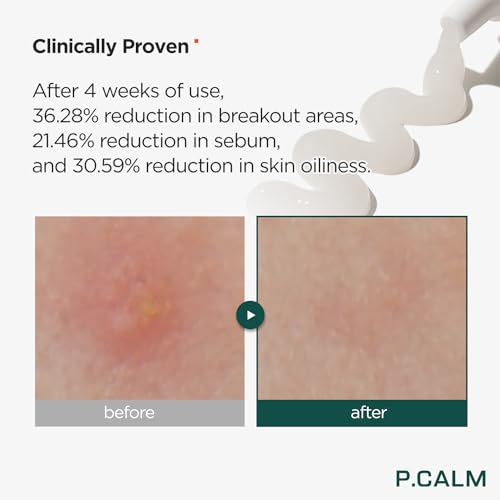 P.CALM Centella Trouble Spot Cream ? Papaya Extract & Centella Asiatica for Intense Soothing & Spot Relief, Korean Skincare (15ml / 0.17 fl.oz)
