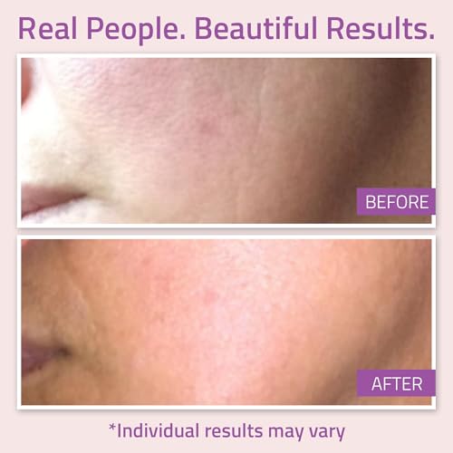 YEOUTH Anti Aging Serum for Face with Hyaluronic Acid, Ferulic Acid, Vitamin C and E, Hydrating Face Serum for Women and Men Targets Dull and Dry Skin 1oz (Pack of 2)