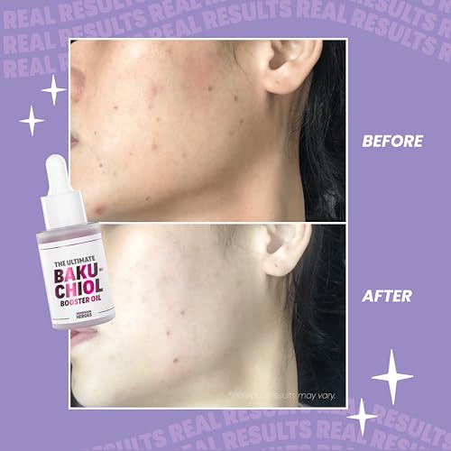Perfect Pout & Glowing Skin Set: Handmade Heroes 100% Natural Vegan Lip Mask & Bakuchiol Booster Oil