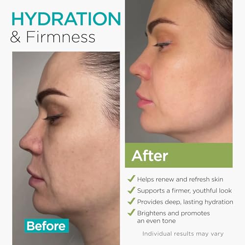 Collagen NAD+ Face Cream with Retinol & Hyaluronic Acid - 1.7 Oz (Variation of THIS listing)