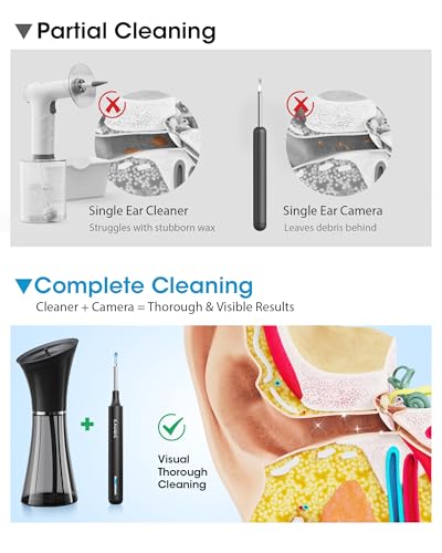 KAUGIC Ear Cleaner with Camera & Irrigation - Black, Overheat Protection