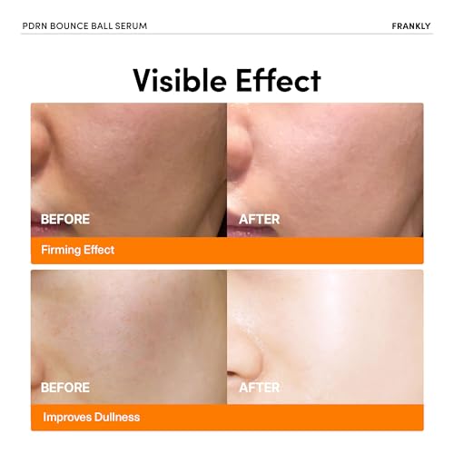 FRANKLY Rejuvenating Duo for Mature Skin ? Retinol 0.1% Cream & Salmon DNA PDRN Serum | Deep Repair & Firming | Korean Skincare | Christmas Gifts for Women