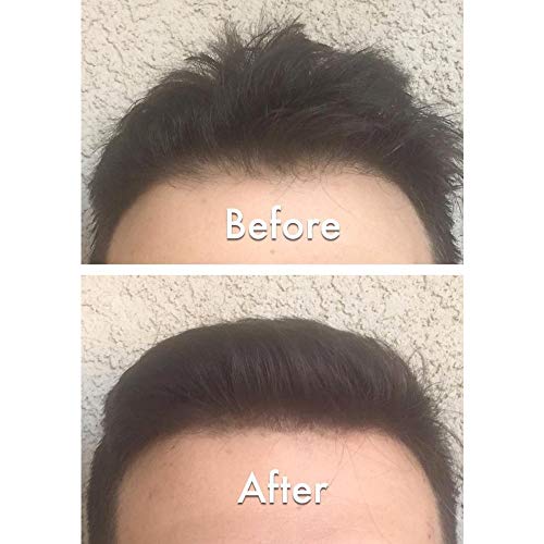 Nor1 Auburn Keratin Hair Building Fibers - Thicker, Fuller Hair Concealer for Men & Women