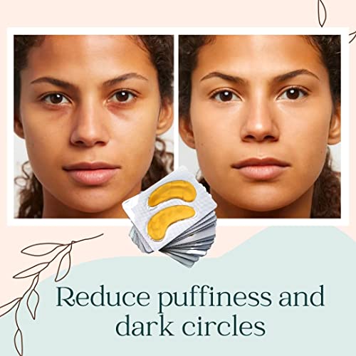 Live Fraiche 24k Gold Under Eye Patches for Dark Circles and Puffiness Treatment - Hyaluronic Acid and Collagen Under Eye Mask to Treat Puffy Eyes and Fine Lines - tiktok trend items