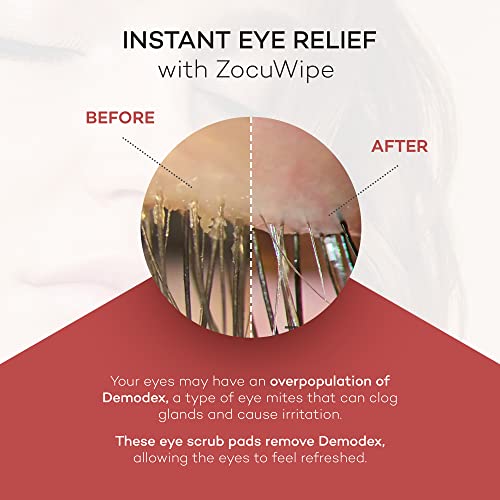 Zocular ZocuWipe Eyelid Cleansing Wipes with Natural Okra Complex ? Gentle Daily Eyelid Cleanser & Moisturizing Pads ? Makeup Remover & Eye Hygiene Wipes ? 30 Count