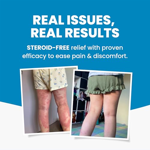 Grahams Natural C+ Eczema & Dermatitis Cream 4.23oz All-Natural, Steroid-Free