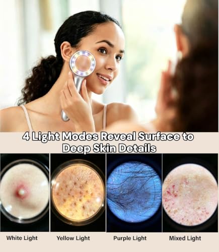 30x Portable Magnifying Dermatoscope with LED Light Modes for Skin & Scalp