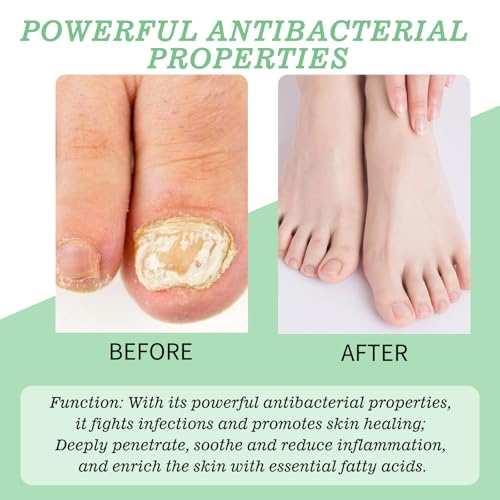 Blinzador ? Natural Spray for Foot & Nail with Plant-Based Ingredients ? Fast-Drying, Odorless, Easy-to-Use | 1oz (30ml), 1 Month Supply