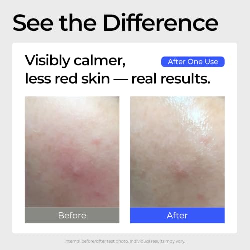 Calming Facial Serum for Sensitive Skin - Korean Skincare 1 Fl Oz
