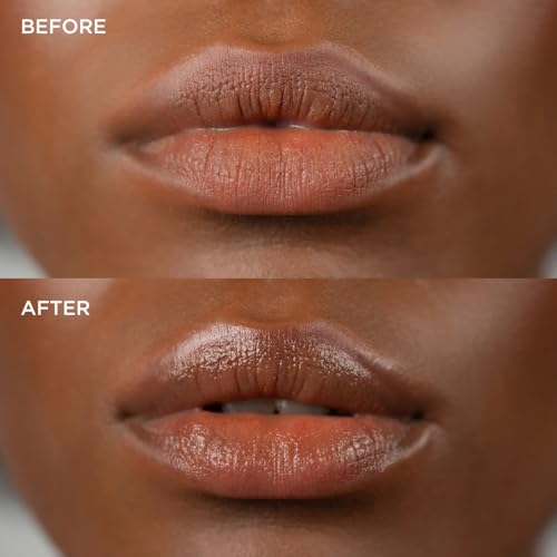 AcneFree Salicylic Acid Acne Pimple Patch Treatment