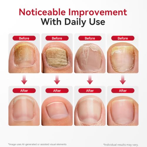 Fungal Nail Patches 76 Count for Toenail Renewal - Deep Root Care & Long-Lasting Fit