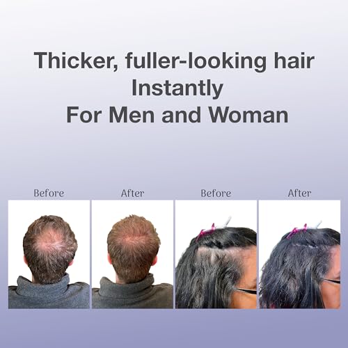 BosleyMD BosVolumize Hair Thickening Fibers - Black, 0.42 oz - Instant Fuller Look