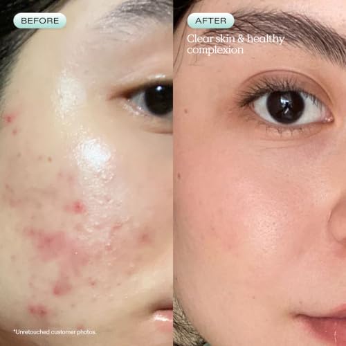 KraveBeauty Great Barrier Relief Face Serum 1.52 Fl Oz for Dry Sensitive Skin