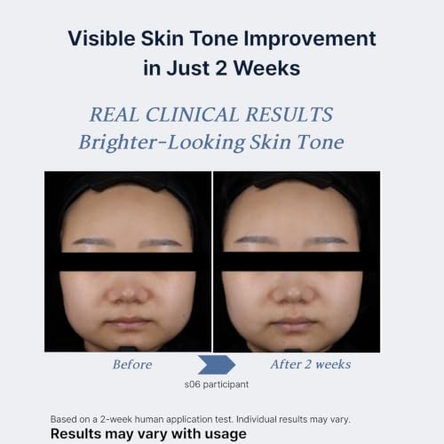 Niacinamide Sheet Mask 10 Pack - Brightening Korean Skin Care
