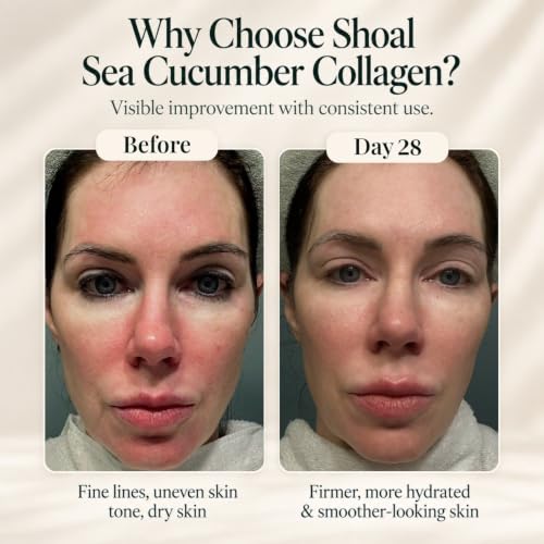Australian Collagen Face Serum with Sea Cucumber & Hyaluronic Acid - Firming & Hydrating, 1 fl oz