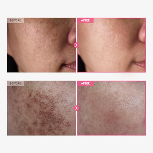 Tone-Refining Skin Care Duo with Arbutin & Peptide Serum for Uneven Skin