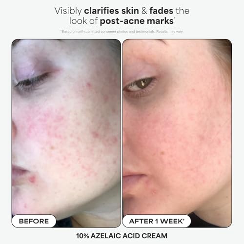Paula's Choice Complexion Clarity Skincare Set - 3 Piece Kit