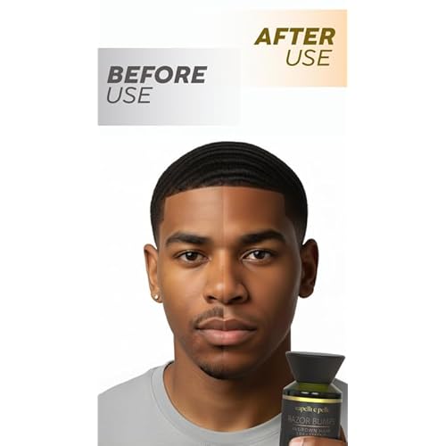 Razor Bumps Ingrown Hair Treatment with Organic Rosemary Oil - 130ml (4.3 Fl Oz)