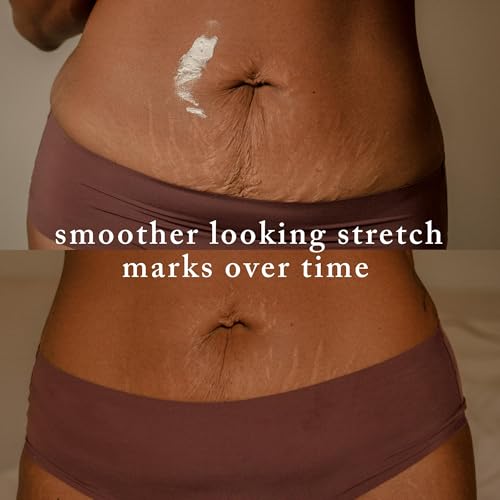 Nemah 3.4 Oz Stretch Mark Cream for Pregnancy, Moisturizing Belly & Body Care