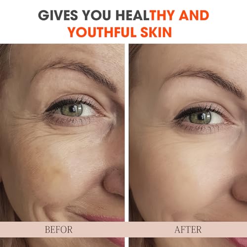 Unscented Vitamin C Serum for Mature Skin - Anti-Aging Face & Neck Treatment