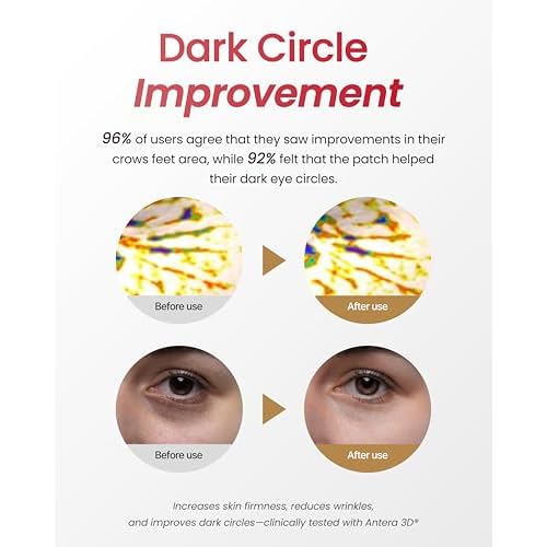 YADAH Red Food Energy Eye Patch 60 Pairs - Hydrogel Under Eye Mask with Pomegranate & Ginseng for Firming, Hydration & Puffiness Reduction.
