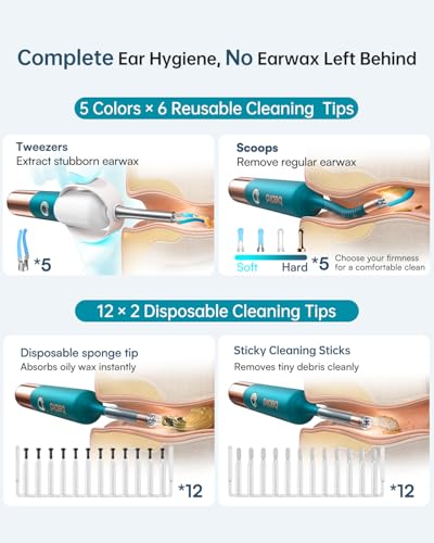 BEBIRD Ultra 2K Ear Cleaner with Camera – Wireless Otoscope for At-Home Ear Wax Removal