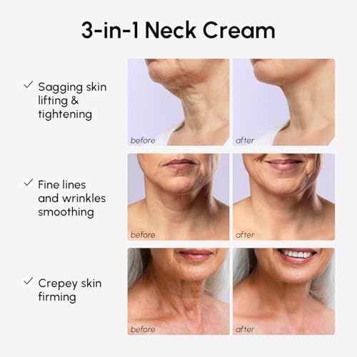 MAREE Neck Cream with Face Roller ? Neck Creams For Tightening and Firming ? Pro Retinol & AH-8 Firming Neck Cream Roller - Face Double Chin Wrinkle Cream for Women - Crema Reafirmante Para el Cuello